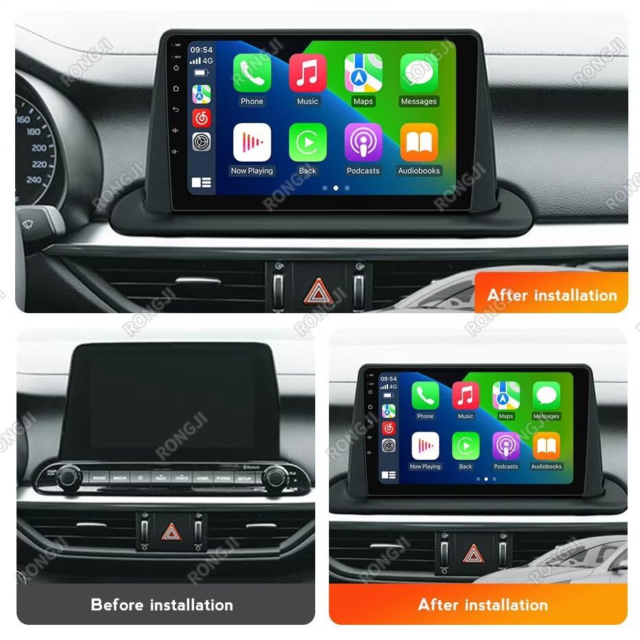 2+64GB Android Radio for Kia Forte Kia Cerato 2018-2021 Stereo Upgrade